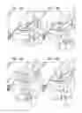 Fig. 06 - Post-implantation tensioning in cardiac implants