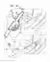 Fig. 08 - Post-implantation tensioning in cardiac implants