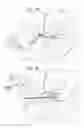 Fig. 09 - Post-implantation tensioning in cardiac implants
