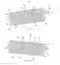 Fig. 08 - Bendable graft containment cage