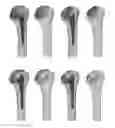 Fig. 01 - Arthroplasty implants and methods for orienting joint prosthesis