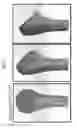Fig. 06 - Arthroplasty implants and methods for orienting joint prosthesis