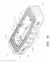 Fig. 02 - METHODS AND SYSTEMS FOR FILLING A SPINAL IMPLANT