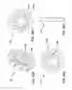 Fig. 45 - Methods and systems for delivering an implant