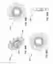 Fig. 71 - Methods and systems for delivering an implant