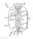 Fig. 01 - System and methods for internalization of external components of an adjustable intragastric balloon