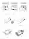 Fig. 08 - Intragastric device for weight management
