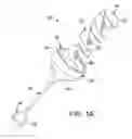 Fig. 02 - Gastric obstruction device deployment assembly and methods of delivering and deploying a gastric obstruction device