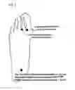 Fig. 02 - APPARATUS METHOD OF INCREASING RATE OF BLOOD FLOW