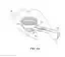 Fig. 07 - Patient interface for ophthalmologic diagnostic and interventional procedures