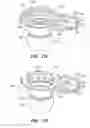 Fig. 20 - Patient interface for ophthalmologic diagnostic and interventional procedures