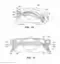 Fig. 22 - Patient interface for ophthalmologic diagnostic and interventional procedures