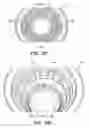 Fig. 32 - Patient interface for ophthalmologic diagnostic and interventional procedures