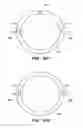 Fig. 34 - Patient interface for ophthalmologic diagnostic and interventional procedures