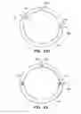 Fig. 35 - Patient interface for ophthalmologic diagnostic and interventional procedures