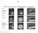 Fig. 02 - Injectable sterile aqueous formulation based on crosslinked hyaluronic acid and hydroxyapatite for aesthetic use