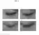 Fig. 02 - Eyelash cleaning agent