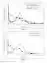 Fig. 08 - Antipsychotic injectable depot composition