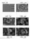 Fig. 02 - Heat-stable dry powder pharmaceutical compositions and methods