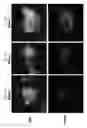 Fig. 07 - Methods and pharmaceutical compositions for improving wound healing using CD24