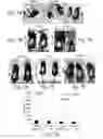 Fig. 08 - Methods and pharmaceutical compositions for improving wound healing using CD24