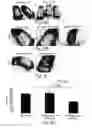 Fig. 09 - Methods and pharmaceutical compositions for improving wound healing using CD24