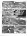 Fig. 06 - Articular Cartilage Mimetics