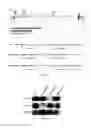 Fig. 02 - Use of a genetically modified infectious measles virus with enhanced pro-apoptotic properties (MV-deltaC virus) in cancer therapy