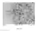 Fig. 28 - TIMED RELEASE OF SUBSTANCES TO TREAT OCULAR DISORDERS
