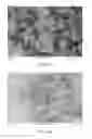 Fig. 37 - TIMED RELEASE OF SUBSTANCES TO TREAT OCULAR DISORDERS