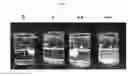 Fig. 02 - Methods for making ultrasound contrast agents