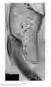 Fig. 07 - Methods of improving bone-soft tissue healing using electrospun fibers