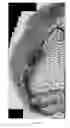 Fig. 09 - Methods of improving bone-soft tissue healing using electrospun fibers