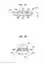 Fig. 04 - Implantable device having one or more screws