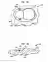 Fig. 07 - Implantable device having one or more screws