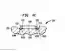 Fig. 08 - Implantable device having one or more screws
