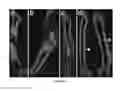 Fig. 05 - Degradable magnesium-based implant devices for bone fixation