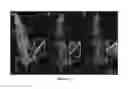 Fig. 10 - Degradable magnesium-based implant devices for bone fixation
