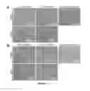 Fig. 12 - Degradable magnesium-based implant devices for bone fixation