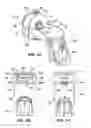 Fig. 02 - PUMPING APPARATUSES AND METHODS FOR FLUID INFUSION