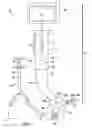 Fig. 02 - Systems, Methods, and Devices for Facilitating Endotracheal Intubation