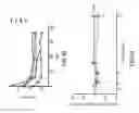 Fig. 41 - Systems, devices and methods for performing medical procedures in the intestine