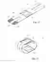 Fig. 06 - Apparatus operable to protect and maintain positioning of an IV catheter