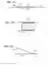 Fig. 41 - INTRAGASTRIC DEVICE