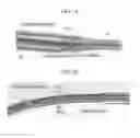 Fig. 02 - IMPLANTABLE HYBRID LEAD AND METHOD OF MANUFACTURING THE SAME