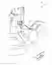 Fig. 01 - System for enhanced sealing of coupled medical fluid lines and method