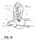 Fig. 17 - Wearable cardiac defibrillator systems and methods and software for contacting non-witnessing responders