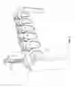 Fig. 06 - Wireless Electrodes