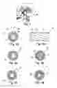 Fig. 02 - Microlead for multipoint neuromodulation of the central nervous system