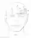 Fig. 07 - Surgical method for implantable neurostimulation system for pain